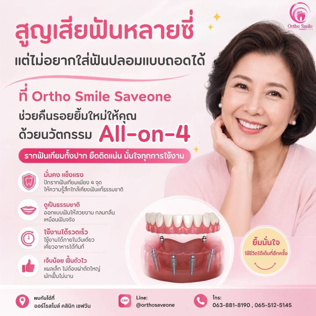 รากฟันเทียม (Dental Implant) — ออร์โธสไมล์ คลินิก เซฟวัน โคราช